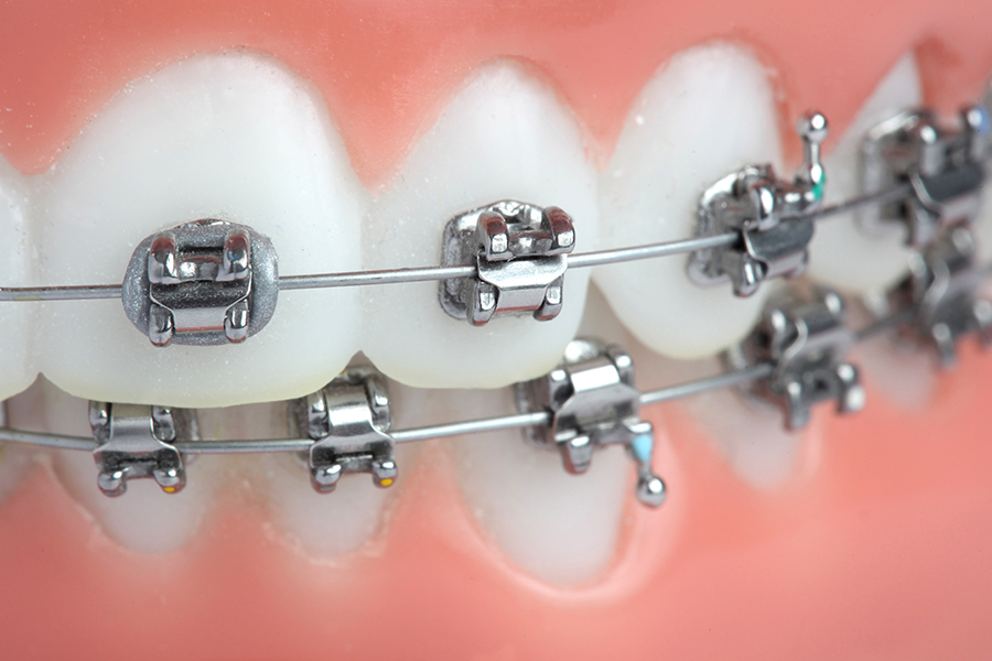 矯正歯科について